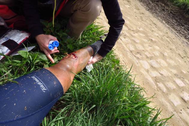 Fran Ventoso's leg roadside after the incident where he has blamed his injury on a disc brake.
