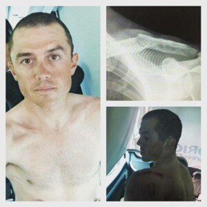 Simon Gerrans has had surgery on a broken collarbone but says he won't recover in time for Rio.