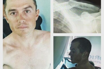 Simon Gerrans has had surgery on a broken collarbone but says he won't recover in time for Rio.