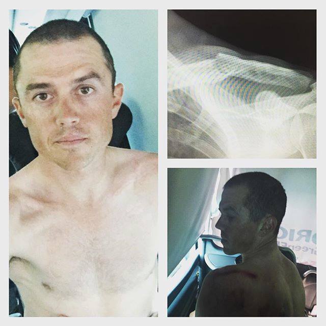 Simon Gerrans has had surgery on a broken collarbone but says he won't recover in time for Rio.