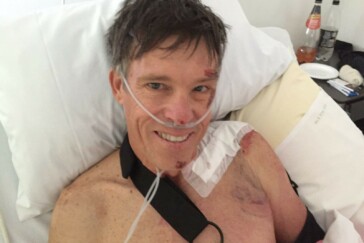 All smiles, Phil Anderson retains his trademark positive persona from his hospital bed. Image: Facebook